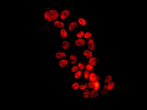Immunocytochemistry/ Immunofluorescence - Anti-BAF53b antibody [EPR10100(B)] (AB140642)