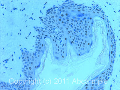 Immunohistochemistry (Formalin/PFA-fixed paraffin-embedded sections) - Anti-BAF57/SMARCE1 antibody (AB70540)