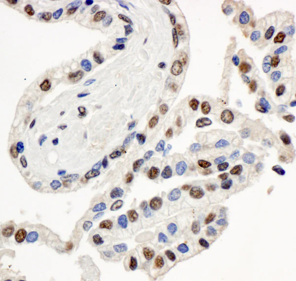 Immunohistochemistry (Formalin/PFA-fixed paraffin-embedded sections) - Anti-BAF57/SMARCE1 antibody (AB70540)