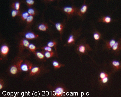 Immunocytochemistry/ Immunofluorescence - Anti-BAF57/SMARCE1 antibody [EPR8848] (ab131328), expandable thumbnail
