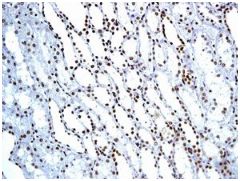 Immunohistochemistry (Formalin/PFA-fixed paraffin-embedded sections) - Anti-BAF57/SMARCE1 antibody [EPR8848] (AB131328), expandable thumbnail