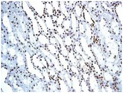 Immunohistochemistry (Formalin/PFA-fixed paraffin-embedded sections) - Anti-BAF57/SMARCE1 antibody [EPR8848] (AB131328)