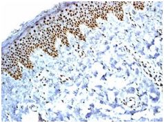 Immunohistochemistry (Formalin/PFA-fixed paraffin-embedded sections) - Anti-BAF57/SMARCE1 antibody [EPR8848] (AB131328), expandable thumbnail