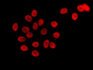 Immunocytochemistry/ Immunofluorescence - Anti-BAF57/SMARCE1 antibody [EPR8849] - ChIP Grade (ab137081), expandable thumbnail