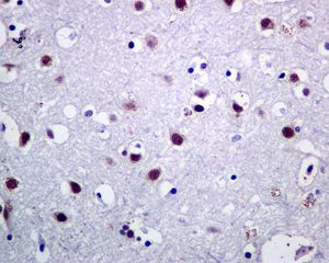 Immunohistochemistry (Formalin/PFA-fixed paraffin-embedded sections) - Anti-BAF57/SMARCE1 antibody [EPR8849] - ChIP Grade (AB137081), expandable thumbnail