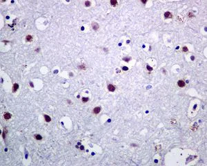 Immunohistochemistry (Formalin/PFA-fixed paraffin-embedded sections) - Anti-BAF57/SMARCE1 antibody [EPR8849] - ChIP Grade (AB137081)