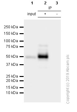 Immunoprecipitation - Anti-BAF57/SMARCE1 antibody [EPR8849] - ChIP Grade (AB137081), expandable thumbnail