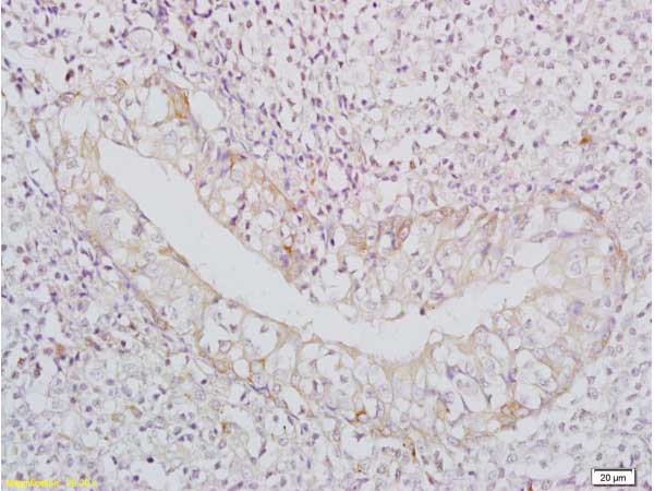 Immunohistochemistry (Formalin/PFA-fixed paraffin-embedded sections) - Anti-BAFF antibody (AB217329)