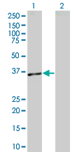 Western blot - BAFF overexpression 293T lysate (whole cell) (AB94114), expandable thumbnail