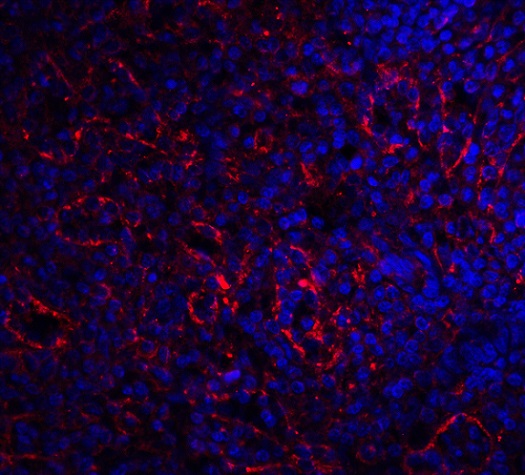 Immunohistochemistry (Formalin/PFA-fixed paraffin-embedded sections) - Anti-BAFF-R antibody (AB5965), expandable thumbnail