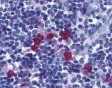 Immunohistochemistry (Formalin/PFA-fixed paraffin-embedded sections) - Anti-BAFF-R antibody (AB5965), expandable thumbnail