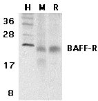 Western blot - Anti-BAFF-R antibody (AB5965), expandable thumbnail