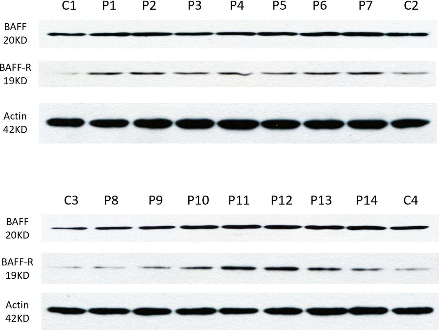Western blot - Anti-BAFF-R antibody (AB5965), expandable thumbnail