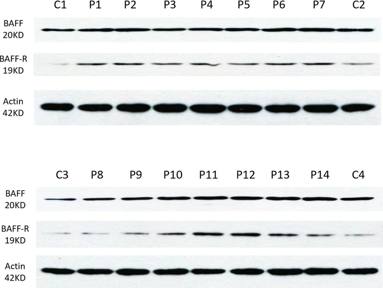 Western blot - Anti-BAFF-R antibody (AB5965)