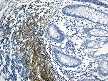 Immunohistochemistry (Formalin/PFA-fixed paraffin-embedded sections) - Anti-BAFF-R antibody [EPR10914] (AB168389)