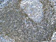 Immunohistochemistry (Formalin/PFA-fixed paraffin-embedded sections) - Anti-BAFF-R antibody [EPR10914] - BSA and Azide free (AB190659)