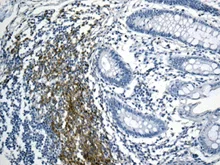 Immunohistochemistry (Formalin/PFA-fixed paraffin-embedded sections) - Anti-BAFF-R antibody [EPR10914] - BSA and Azide free (AB190659)