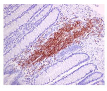 Immunohistochemistry (Formalin/PFA-fixed paraffin-embedded sections) - Anti-BAFF-R antibody [EPR14633] (AB188868)