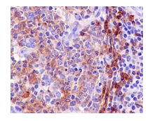 Immunohistochemistry (Formalin/PFA-fixed paraffin-embedded sections) - Anti-BAFF-R antibody [EPR14633] (AB188868)