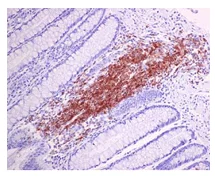 Immunohistochemistry (Formalin/PFA-fixed paraffin-embedded sections) - Anti-BAFF-R antibody [EPR14633] - BSA and Azide free (AB250978)