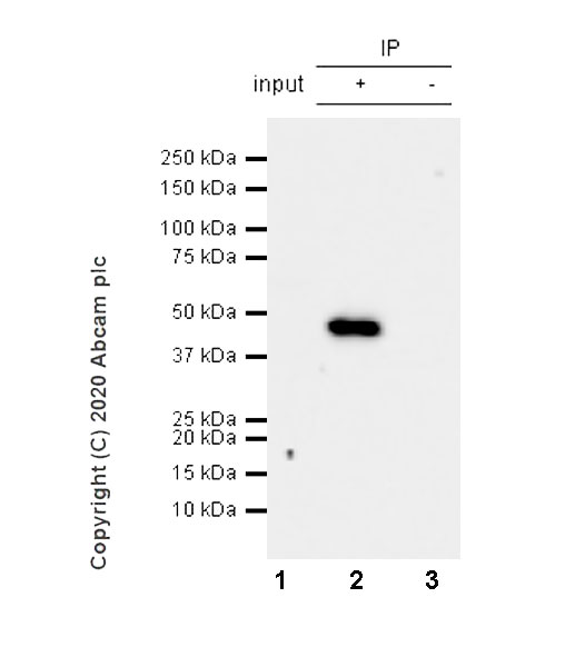 Immunoprecipitation - Anti-BAFF-R antibody [EPR23590-68] (AB273569), expandable thumbnail