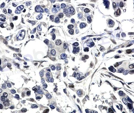 Immunohistochemistry (Formalin/PFA-fixed paraffin-embedded sections) - Anti-Bag1 antibody [SR1542] (AB326691)