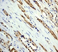 Immunohistochemistry (Formalin/PFA-fixed paraffin-embedded sections) - Anti-Bag1 antibody [Y166] (AB32109)