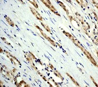 Immunohistochemistry (Formalin/PFA-fixed paraffin-embedded sections) - Anti-Bag1 antibody [Y166] - BSA and Azide free (AB211754)