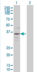Western blot - Bag1 overexpression 293T lysate (whole cell) (AB94217)
