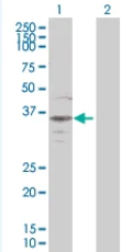 Western blot - Bag1 overexpression 293T lysate (whole cell) (AB94217)