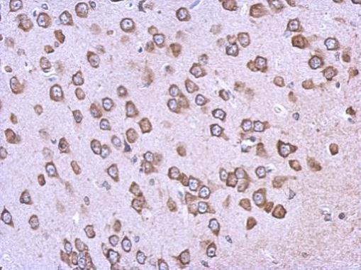 Immunohistochemistry (Formalin/PFA-fixed paraffin-embedded sections) - Anti-BAG2 antibody (AB229089)