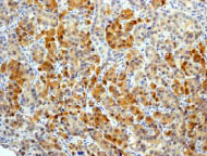 Immunohistochemistry (Formalin/PFA-fixed paraffin-embedded sections) - Anti-BAG2 antibody [EPR3567] (AB79406), expandable thumbnail