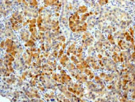 Immunohistochemistry (Formalin/PFA-fixed paraffin-embedded sections) - Anti-BAG2 antibody [EPR3567] (AB79406)