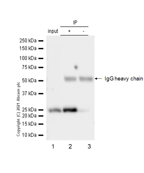 Immunoprecipitation - Anti-BAG2 antibody [EPR3567] - BSA and Azide free (AB247500)