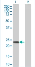 Western blot - BAG2 overexpression 293T lysate (whole cell) (AB94218)