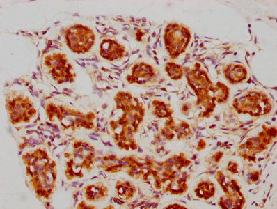 Immunohistochemistry (Formalin/PFA-fixed paraffin-embedded sections) - Anti-Bag3 antibody [3D8] (AB314006)