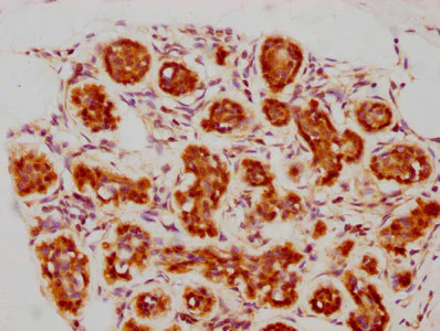Immunohistochemistry (Formalin/PFA-fixed paraffin-embedded sections) - Anti-Bag3 antibody [3D8] (AB314006)