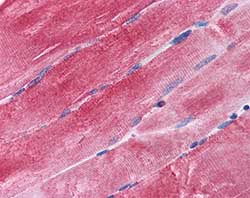 Immunohistochemistry (Formalin/PFA-fixed paraffin-embedded sections) - Anti-Bag3 antibody (AB112016)