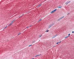 Immunohistochemistry (Formalin/PFA-fixed paraffin-embedded sections) - Anti-Bag3 antibody (AB112016)