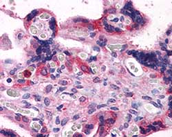 Immunohistochemistry (Formalin/PFA-fixed paraffin-embedded sections) - Anti-Bag3 antibody (AB112016)