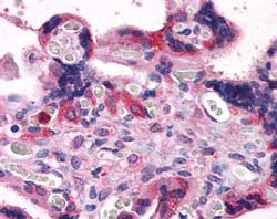 Immunohistochemistry (Formalin/PFA-fixed paraffin-embedded sections) - Anti-Bag3 antibody (AB112016)