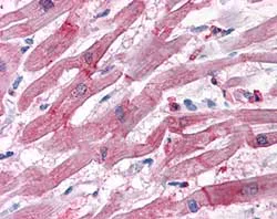 Immunohistochemistry (Formalin/PFA-fixed paraffin-embedded sections) - Anti-Bag3 antibody (AB112016)