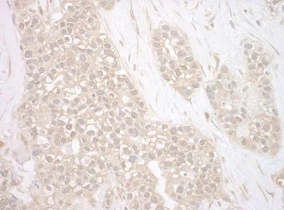 Immunohistochemistry (Formalin/PFA-fixed paraffin-embedded sections) - Anti-Bag3 antibody (AB193463)