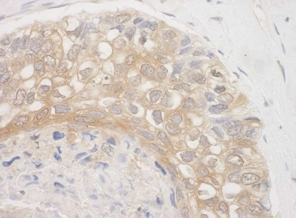 Immunohistochemistry (Formalin/PFA-fixed paraffin-embedded sections) - Anti-Bag3 antibody (AB225561)