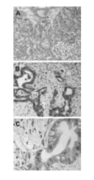 Immunohistochemistry (Formalin/PFA-fixed paraffin-embedded sections) - Anti-Bag3 antibody (AB47124)