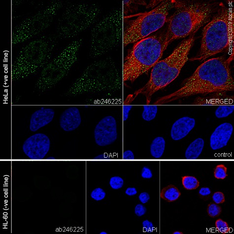 Immunocytochemistry/ Immunofluorescence - Anti-Bag3 antibody [EPR20207-58-4] (AB246225), expandable thumbnail