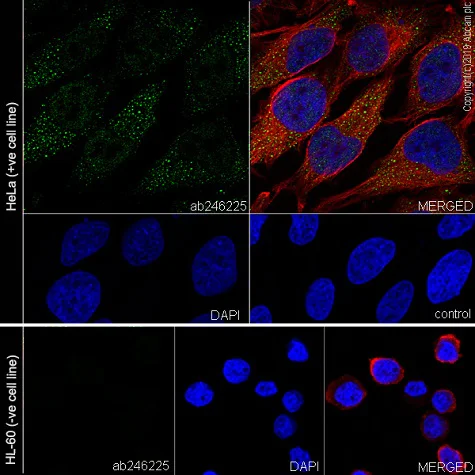Immunocytochemistry/ Immunofluorescence - Anti-Bag3 antibody [EPR20207-58-4] - BSA and Azide free (AB252389)