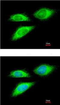 Immunocytochemistry/ Immunofluorescence - Anti-Bag5 antibody (AB97660), expandable thumbnail