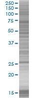 SDS-PAGE - Bag5 overexpression 293T lysate (whole cell) (AB94322), expandable thumbnail