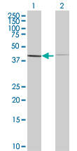 Western blot - Bag5 overexpression 293T lysate (whole cell) (AB94322), expandable thumbnail